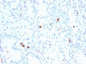 Anti-Gastrin Mouse Monoclonal Antibody [clone: GAST/2634]