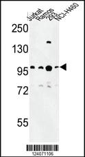 Anti-BCL11A Rabbit Polyclonal Antibody