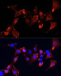 Immunofluorescence analysis of NIH-3T3 cells using Anti-CLUH Antibody (A11250) at a dilution of 1:100 (40X lens). DAPI was used to stain the cell nuclei (blue)