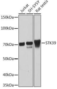 Western blot analysis of extracts of various cell lines, using Anti-SPAK Antibody [ARC1896] (A308775) at 1:1000 dilution. The secondary Antibody was Goat Anti-Rabbit IgG H&L Antibody (HRP) at 1:10000 dilution. Lysates/proteins were present at 25 µg per lane