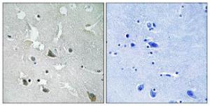 Immunohistochemical analysis of paraffin-embedded human brain using Anti-TIRAP (phospho Tyr86) Antibody. The right hand panel represents a negative control, where the antibody was pre-incubated with the immunising peptide