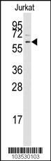 Anti-TGF beta Receptor I (TGFBR1) Rabbit Polyclonal Antibody