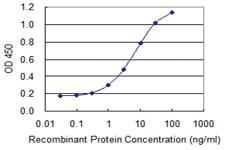 Anti-CYLD Mouse Monoclonal Antibody [clone: 3A9]