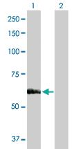 Anti-SARS Rabbit Polyclonal Antibody