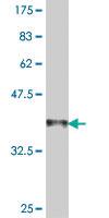 Anti-ACTG2 Mouse Polyclonal Antibody