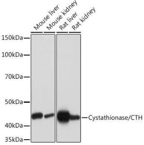 Anti-Cystathionase/CTH Rabbit Monoclonal Antibody [clone: ARC1200]