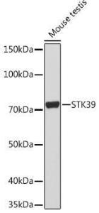 Western blot analysis of extracts of Mouse testis, using Anti-SPAK Antibody [ARC1896] (A308775) at 1:1000 dilution. The secondary Antibody was Goat Anti-Rabbit IgG H&L Antibody (HRP) at 1:10000 dilution. Lysates/proteins were present at 25 µg per lane