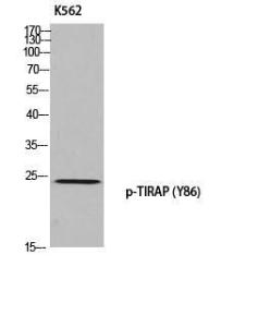 Western blot analysis of K562 using Anti-TIRAP (phospho Tyr86) Antibody