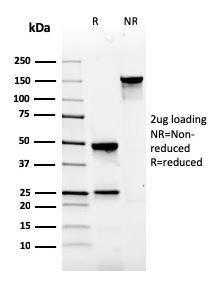 Anti-Gastrin Mouse Monoclonal Antibody [clone: GAST/2634]