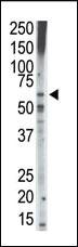 Anti-TGF beta Receptor I (TGFBR1) Rabbit Polyclonal Antibody