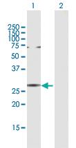 Anti-NAB2 Rabbit Polyclonal Antibody