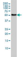 Anti-SARS Mouse Monoclonal Antibody [clone: 1H4]