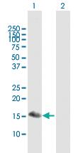 Anti-BATF3 Mouse Polyclonal Antibody