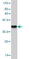 Anti-CYP24A1 Mouse Monoclonal Antibody [clone: 1F8]