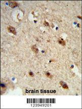 Anti-ACP1 Rabbit Polyclonal Antibody (FITC (Fluorescein Isothiocyanate))