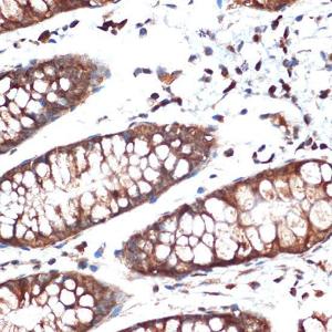 Immunohistochemistry analysis of paraffin-embedded human colon tissue using Anti-SPAK Antibody [ARC1896] (A308775) at a dilution of 1:100 (40X lens). Perform microwave antigen retrieval with 10 mM Tris/EDTA buffer pH 9.0 before commencing with IHC staining protocol