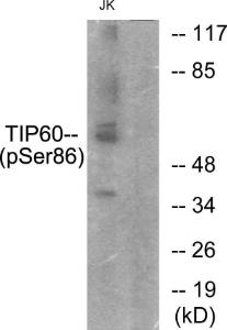 Western blot analysis of lysates from Jurkat cells using Anti-TIP60 (phospho Ser86) Antibody. The right hand lane represents a negative control, where the antibody is blocked by the immunising peptide