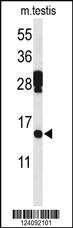 Anti-PDCD5 Rabbit Polyclonal Antibody