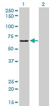 Anti-SARS Mouse Monoclonal Antibody [clone: 1H4]