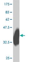 Anti-IL27RA Mouse Monoclonal Antibody [clone: 8G9]