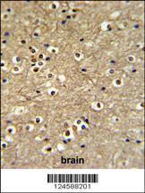 Anti-ETS2 Rabbit Polyclonal Antibody (FITC (Fluorescein Isothiocyanate))