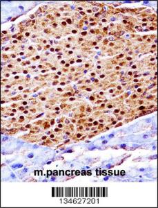 Anti-SCYL3 Rabbit Polyclonal Antibody (HRP (Horseradish Peroxidase))