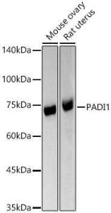 Anti-PADI1/PAD1 Antibody (A11251)