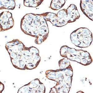 Immunohistochemistry analysis of paraffin-embedded human placenta using Anti-SPAK Antibody [ARC1896] (A308775) at a dilution of 1:100 (40X lens). Perform microwave antigen retrieval with 10 mM Tris/EDTA buffer pH 9.0 before commencing with IHC staining protocol