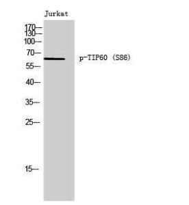 Western blot analysis of Jurkat cells using Anti-TIP60 (phospho Ser86) Antibody