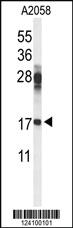 Anti-RPS11 Rabbit Polyclonal Antibody