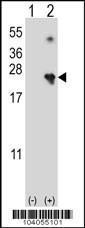 Anti-Nucleoside Diphosphate Kinase D Rabbit Polyclonal Antibody (Biotin)