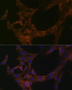 Immunofluorescence analysis of NIH-3T3 cells using Anti-SPAK Antibody [ARC1896] (A308775) at a dilution of 1:100 (40X lens). DAPI was used to stain the cell nuclei (blue)