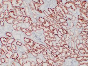 Anti-Von Hippel Lindau/VHL Mouse Monoclonal Antibody [clone: ABT-PVHL]