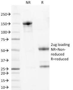 SDS-PAGE analysis of Anti-Wilms Tumor Protein Antibody [6F-H2] under non-reduced and reduced conditions; showing intact IgG and intact heavy and light chains, respectively. SDS-PAGE analysis confirms the integrity and purity of the antibody