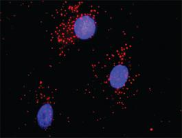 Anti-ACTN1 + CAMK2A Antibody Pair