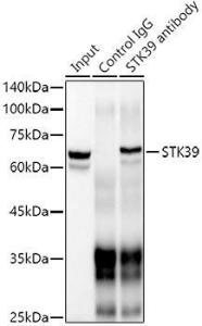 Immunoprecipitation analysis of 300 µg extracts of Jurkat cells using 3 µg of Anti-SPAK Antibody [ARC1896] (A308775). This Western blot was performed on the immunoprecipitate using Anti-SPAK Antibody [ARC1896] (A308775) at a dilution of 1:1000