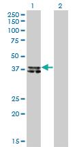 Anti-B4GALT4 Mouse Monoclonal Antibody [clone: 5E2]