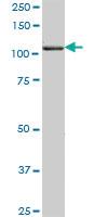 Anti-USP10 Mouse Polyclonal Antibody