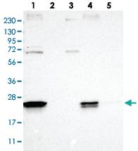 Anti-FAM213A Rabbit Polyclonal Antibody