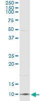 Anti-CCL18 Antibody Pair