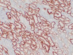 Anti-Von Hippel Lindau/VHL Mouse Monoclonal Antibody [clone: ABT-PVHL]