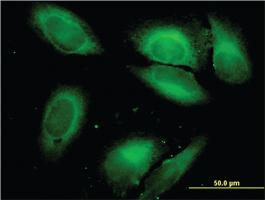 Anti-SARS Mouse Monoclonal Antibody [clone: 1H4]