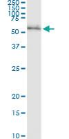 Anti-RPS6KB2 Polyclonal Antibody Pair