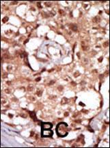 Anti-RIPK2 Rabbit Polyclonal Antibody (AP (Alkaline Phosphatase))