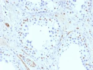 Immunohistochemical analysis of formalin-fixed, paraffin-embedded human testis using Anti-Wilms tumor Protein Antibody [6F-H2]