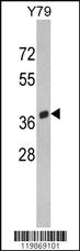 Anti-SPARC Rabbit Polyclonal Antibody