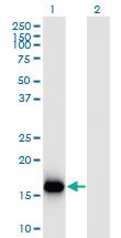 Anti-BATF3 Mouse Monoclonal Antibody [clone: 3H1]