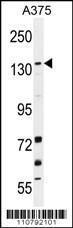 Anti-KDM4B Rabbit Polyclonal Antibody (FITC (Fluorescein Isothiocyanate))