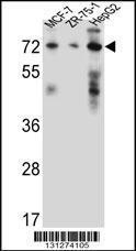 Anti-HSD17B4 Rabbit Polyclonal Antibody (AP (Alkaline Phosphatase))