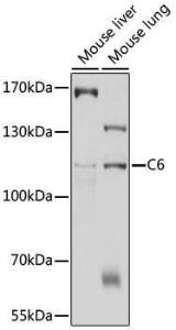 Western blot analysis of extracts of various cell lines, using Anti-C6 Antibody (A11255) at 1:1,000 dilution The secondary antibody was Goat Anti-Rabbit IgG H&L Antibody (HRP) at 1:10,000 dilution Lysates/proteins were present at 25 µg per lane